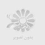 مشاوره ایمپلنت در رشت